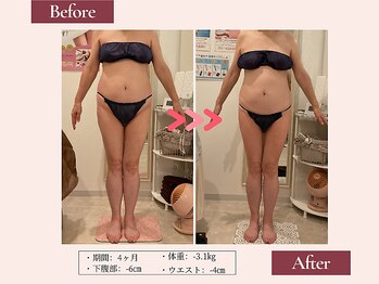 リムサロン(RIMSALON)/