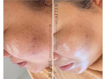 ザ ヴォーグ(the VOGUE)/ツヤ/ノーファンデ肌