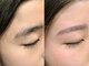 アイブロウドット 京都(iBORW.)の写真/“お顔のトーン・肌艶アップ”痛みが少ないＷＡＸ脱毛で汚れや古い角質をしっかり落としましょう◎