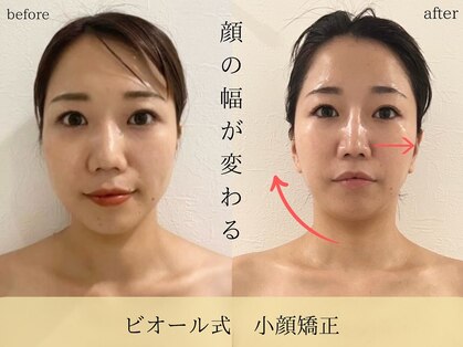 ビオール 表参道(beall)の写真
