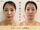 ビオール 表参道(beall)の写真