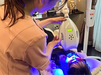 セルフダック 宮城角田店(SELFDUCK)/ホワイトニングの様子