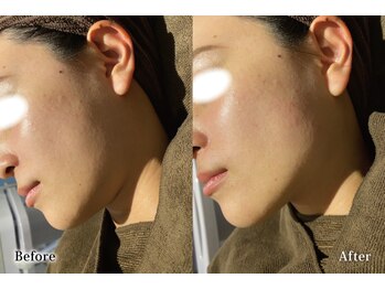 アネル うるま店(anel)/