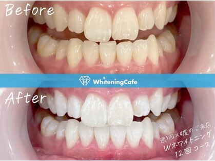 ホワイトニングカフェ 千葉店の写真