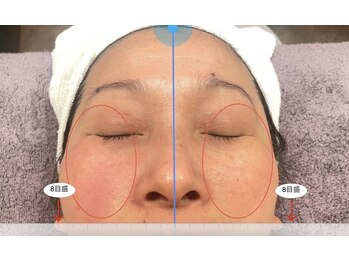 ハイナ 恵比寿店(Hi-Na)/恵比寿/フェイシャル/ブライダル