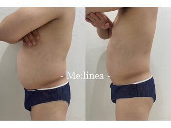 ミーリネア 南堀江(Me:linea)/サブスクも大人気♪