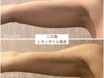 スマイルビューティラボ 別府店(Smile Beauty lab.)の写真