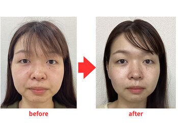 ブプラ 小倉店(BUPURA)/