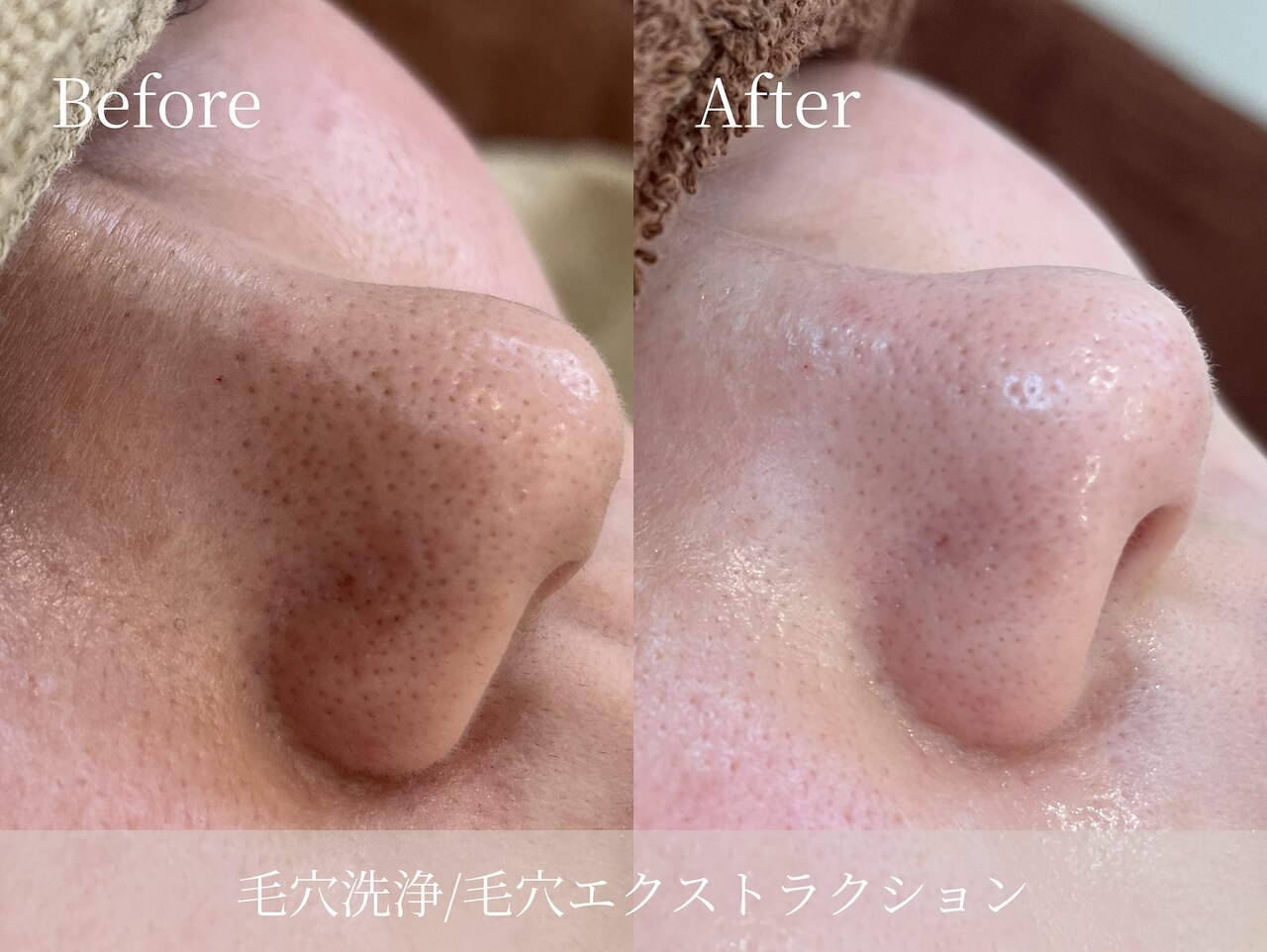 ルミセル(LUMICEL)｜ホットペッパービューティー