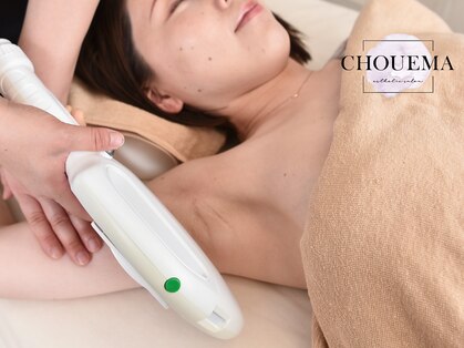 シュエマ(CHOUEMA)の写真
