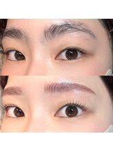 ミリヘレン(MILLI HELEN)/劇的ビフォーアフター★