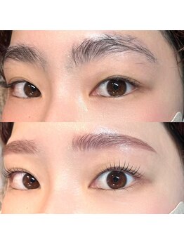 ミリヘレン(MILLI HELEN)/劇的ビフォーアフター★