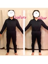 ヨサパーク ココロ 町田店(YOSA PARK COCORO)/Beforeafter