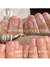 スティラ(Stila)/自爪育成/深爪育成/ネイルケア