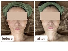 愛 まぁる/小顔リンパマッサージ☆