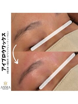 アクシア ビューティー サロン(AXSIA)/【HBL】BeforeAfter