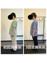 熊本カワル整体 JR上熊本駅院/3回目のお客様