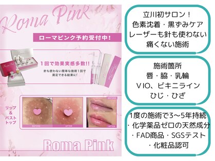 エピス(Epice)の写真