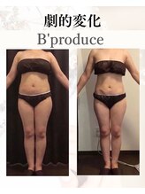 ビープロデュース 亀有店(B’PRODUCE)/Before &after