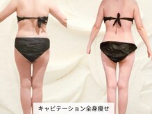 トレゾール(tresor)/【痩身】赤坂痩身エステtresor