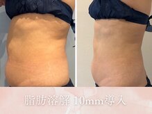 ヤエシーファイブクリニック(YAE C5 CLINIC)の雰囲気（札幌/大通/桑園/痩身/ダイエット/レモンボトル/小顔）