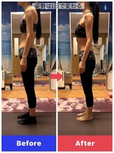 カノア 麻布十番(Kanoa)/猫背/巻き肩/姿勢改善/骨盤矯正