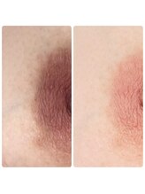 クク(ququ)/【バストトップ】ローマピンク