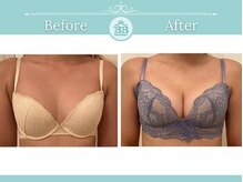 美人バスト 新潟店/ 【バストアップ★育乳】症例