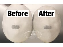 美極 トータルビューティー(美極 TOTAL BEAUTY)/恵比寿/小顔コルギ/エステ/