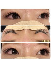 グリュック(Gluck)/フラットラッシュ