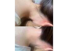 美容コルギサロン コハク(KOHAK)