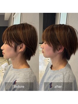 プライミー(PRIMY)/小顔矯正!施術回数1回