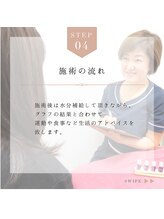 プリモ(Primo)/施術の流れ:4