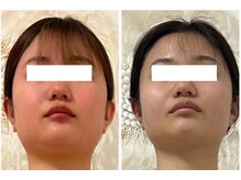 カレン(KAREN)/脂肪燃焼×セルゼロ＃小顔