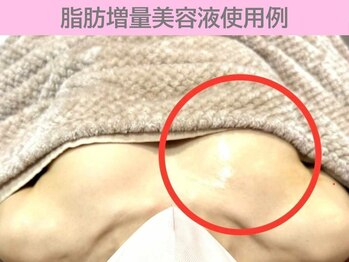 ぷるるんエステ/バストケア/バストアップ/育乳