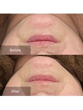 トニック バイ まつもと整骨院鍼灸院(Tonic)/★Before After★ 豊中／毛穴