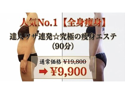 トニートニー(Tony Tony)の写真