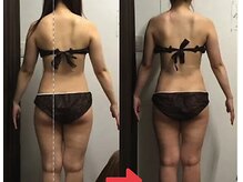 ビープロデュース 尾張旭店(B' PRODUCE)/ &nbsp;リンパマッサージ/痩身/ヘッド