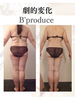 ビープロデュース 亀有店(B’PRODUCE)/Before &after