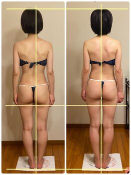 トータルボディセラピーハート(Heart)の写真/【バストアップ×痩身】メリハリBODYに痩せるが叶う★お腹ポッコリ/背中肉/脇肉/ヒップUP/くびれを全部解決