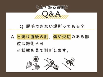 ワックスサロン ジー(waxsalon Gee!)/脱毛Q&A♪なんでもご相談下さい!