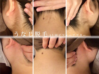 リノ(Lino)の写真