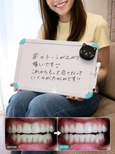 ココホワイトニング(coco whitening)