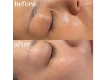 サロン モナ(Salon Mona)の雰囲気（結果重視ピーリング剤で市販では手に入らない高濃度美容液を導入）