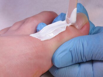 グラティアス(Gratias.)/足指脱毛