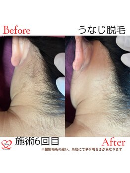 オリオンドットエスツー(Orion.S2)/【Before→After】