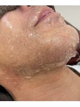 カルディエ(Cardie)/ポップアップ現象