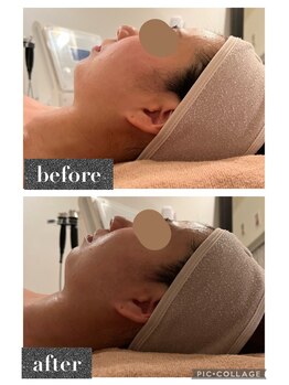 マンダ 田町(Manda)/お顔~首周りのむくみも改善