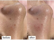 ビジュープラス ひたち野うしく店(Bijou+)/