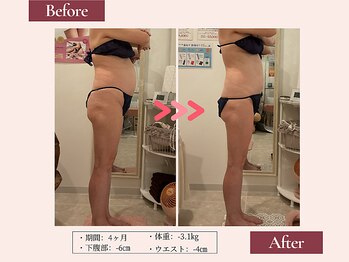 リムサロン(RIMSALON)/